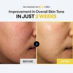 MEDIHEAL Toner Pads Bright Toning - Image 5