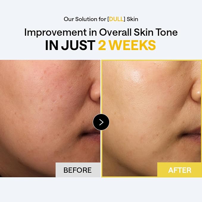 MEDIHEAL Toner Pads Bright Toning - Image 5