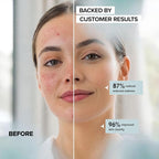 Face Towels - Ultra Soft and Thick Disposable Face Towelettes - Image 2