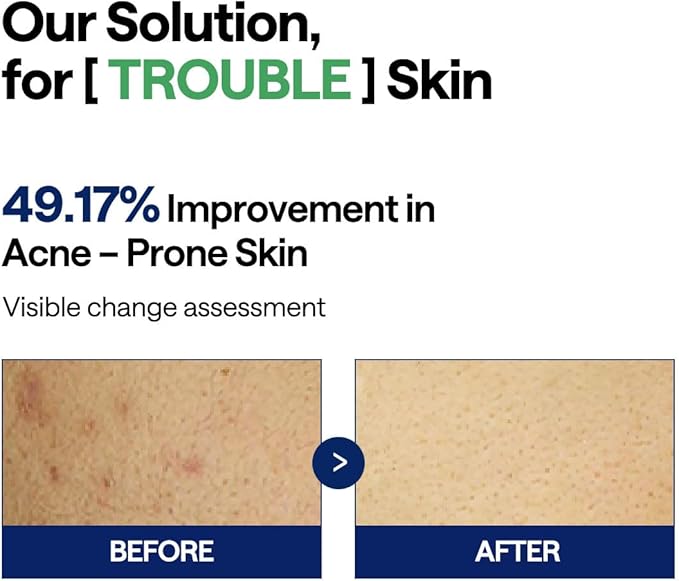 MEDIHEAL Teatree Trouble Pad - Image 4