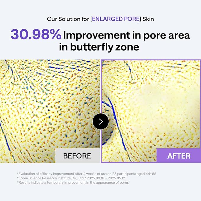 MEDIHEAL Toner Pads - Image 5