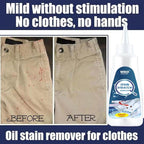 Active Enzyme Laundry Stain Remover, Active Enzyme Clothing Stain Remover - Image 6
