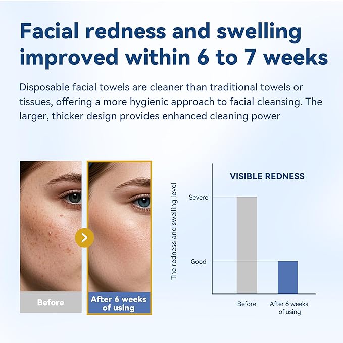 Disposable Face Towelettes, Makeup Remover Dry Wipes, Ultra Soft, 100% Biobased - Image 2