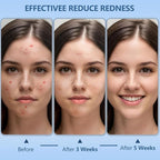 Disposable Face Towels Travel, Ultra Soft Facial Towels - Image 3