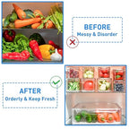 POMEAT 10 Pack Fridge Organizer, Stackable Refrigerator Organizer Bins - Image 7