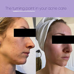 Disposable Face Towels XL, Makeup Remover Cleansing Wipes, 100% Natural - Image 4