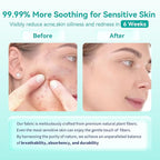 Face Towels, Face Towelettes XL, Ultra Soft Makeup Remover Dry Wipes, Thick - Image 6