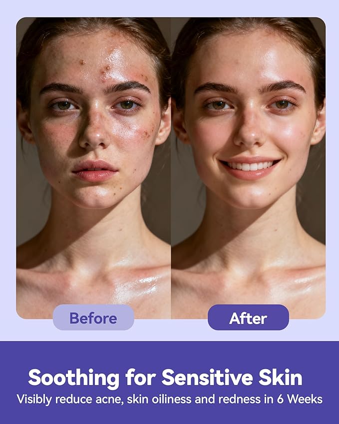 Face Towels Disposable, Face Towelette Disposable, Soft Disposable Face Towel - Image 7