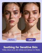 Face Towels Disposable, Face Towelette Disposable, Soft Disposable Face Towel - Image 7