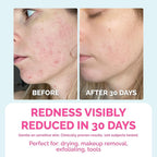 Elizabeth Mott Thank Me Later Disposable Face Towels – 100% Biobased Facial - Image 2