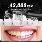 Diamond Style - Sonic Electric Toothbrush - Image 6