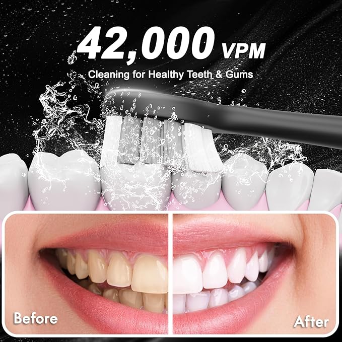 Diamond Style - Sonic Electric Toothbrush - Image 6