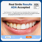 Bitvae ADA Accepted Electric Toothbrush, Travel Toothbrush Rechargeable - Image 3